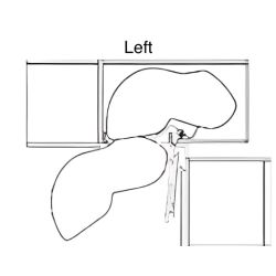 Blind Base Kidney Pullout